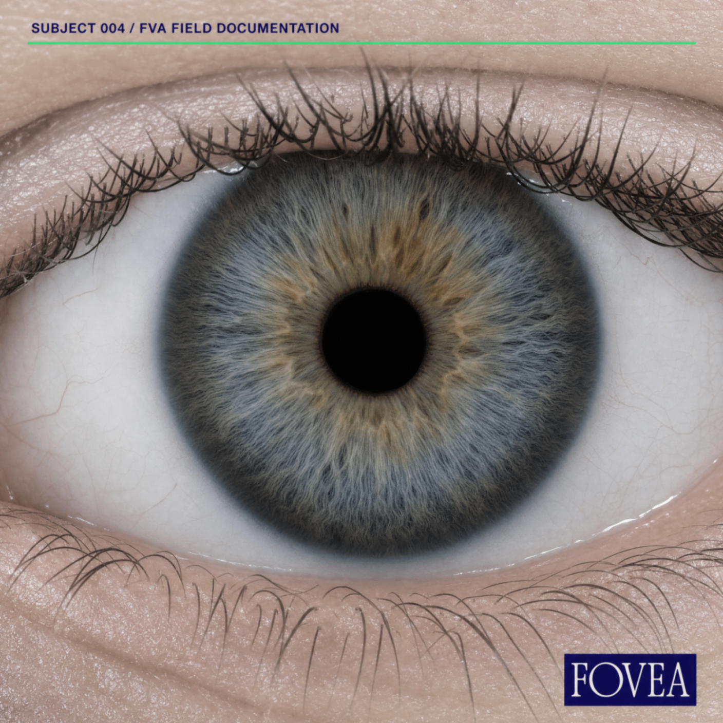 A close-up iris portrait labeled as FVA field documentation, showing the eye as a specimen surface.